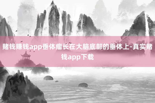 赌钱赚钱app垂体瘤长在大脑底部的垂体上-真实赌钱app下载